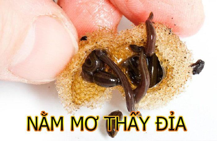 Nằm mơ thấy đỉa là điềm báo gì? Nằm mơ thấy đỉa là điềm báo gì?
