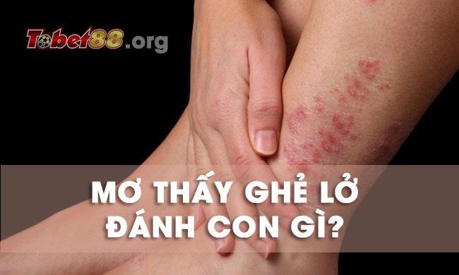 Nằm mơ thấy ghẻ lở là điềm báo gì cho tương lai? nằm mơ thấy bị ghẻ lở