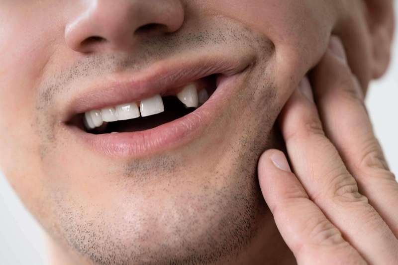 nằm mơ thấy gãy răng không chảy máu