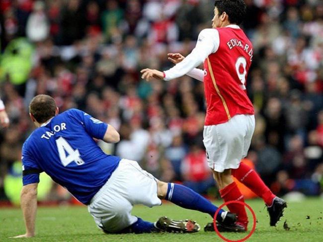 Eduardo Da Silva gặp tai nạn bóng đá phải nghỉ thi đấu 1 năm Eduardo Da Silva gặp tai nạn bóng đá phải nghỉ thi đấu 1 năm